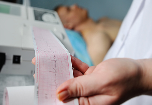ECG (نوار قلب)